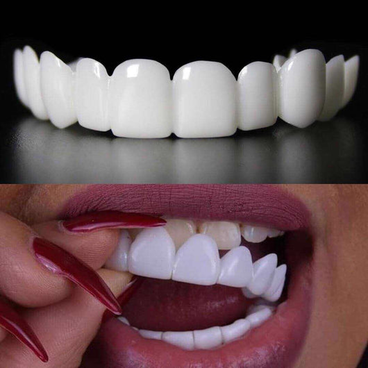 Snap-on Teeth Veneers